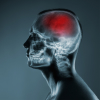 Chicago Traumatic Brain injuries (TBI) Attorney Image